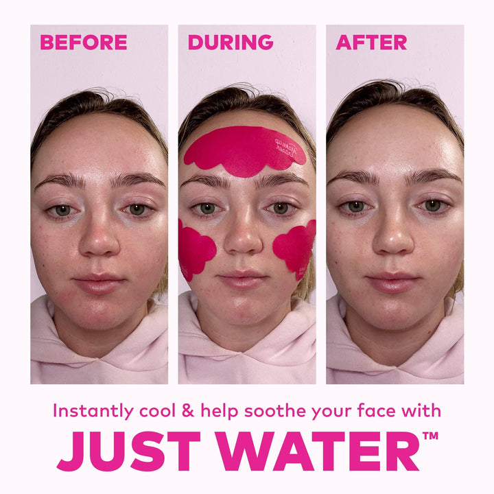 Facial Cooling Clouds Reusable Patches | Instant Cooling